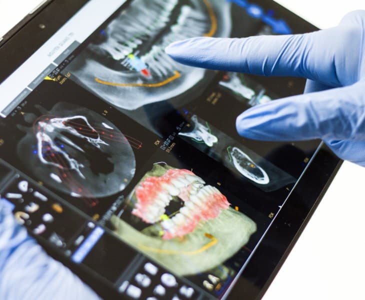 Jak IQ Dental ułatwia wykonywanie zabiegów stomatologicznych?